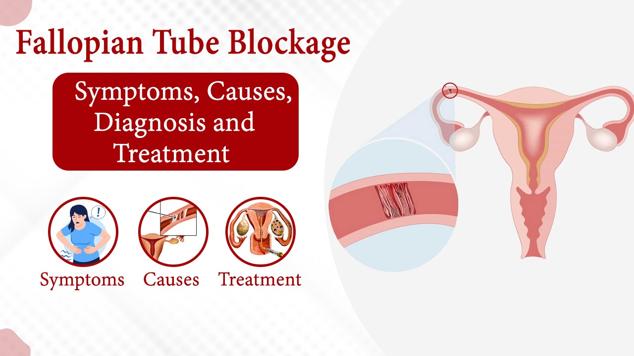 How to open blocked fallopian tubesband fallopian tube ka ilaj